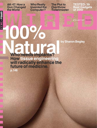 Illustration for article titled Coming Soon: Bigger Boobs Made From Your Liposuctioned Fat